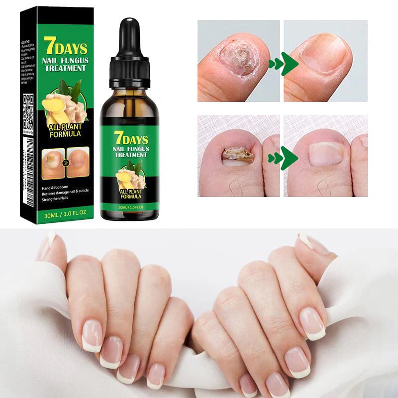 Ingefära nagelbehandling